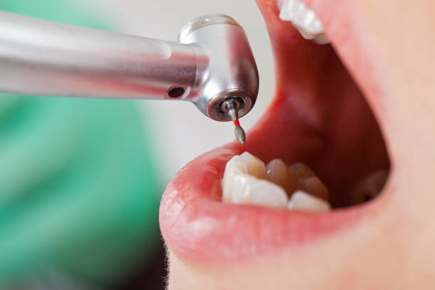 Best Pediatric Emergency Dentist in Breese, IL
